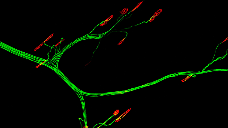 Neuromuscular Junctions