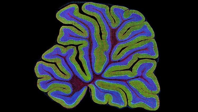 An image of the cerebellum