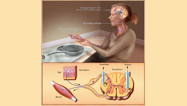 Diagram of pain receptors