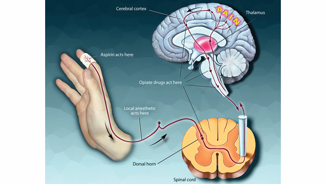 Diagram of how painkillers work