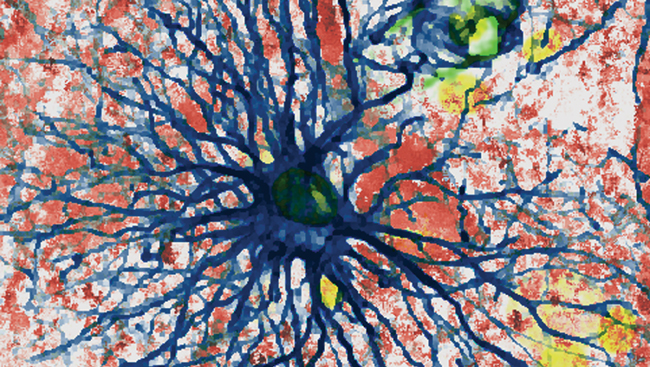 Immunofluorescent labeling of a human cortical astrocyte with GFAP