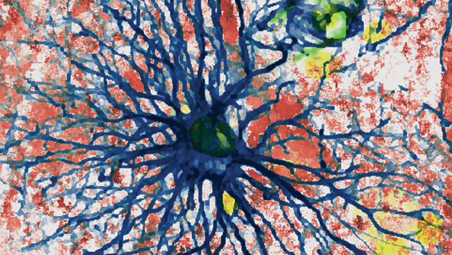  Immunofluorescent labeling of a human cortical astrocyte with GFAP 