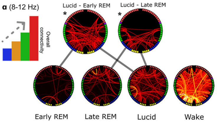 A diagram of heightened alpha wave connectivity
