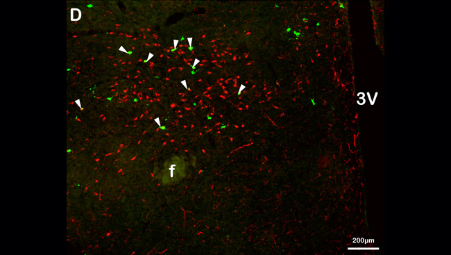 Cells in the hypothalamus