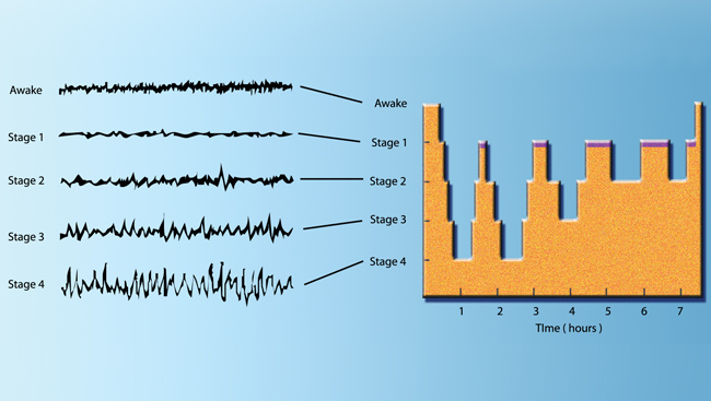 This chart shows the brain waves of a young adult recorded by an electroencephalogram (EEG) during a night's sleep. 