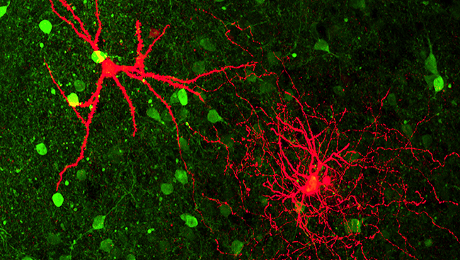 This image shows two types of neurons (pictured in red) — located in the medial amygdala of a mouse — which are involved in the emotional processing of odor information. While both types receive scent information, they communicate this information to different cells — which is reflected in their projections. The cell on the top-left relays information to the hypothalamus some distance away, a brain region important in reproductive and defense behaviors. The bottom-right cell communicates with nearby neurons to dampen the signals they send. Together, these cells help the animal to know whether to prepare for courtship or to flee for safety.