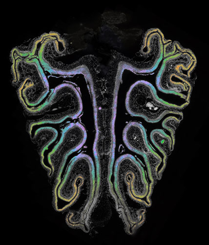 Mouse nose features a color-coded map