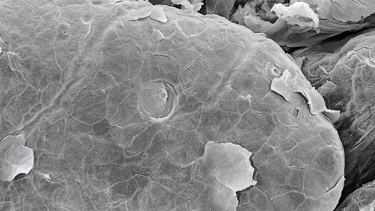 fungiform papilla on tongue