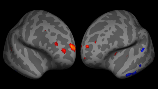 Cortical surface of the human brain