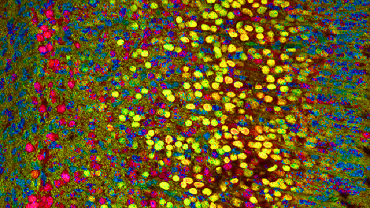 An image of the cerebral cortex of an embryonic mouse, where scientists labelled each type of neuron with a different color. 