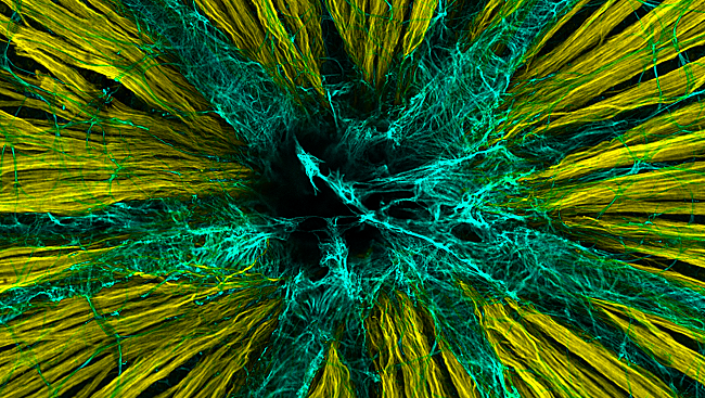 Axons of nerve cells (pictured in yellow) extend through a small opening in the back of the eye (in black) through the optic nerve to higher vision centers. The axons must penetrate another layer of cells known as astrocytes (in blue), which provide nutritional support to the retina. 