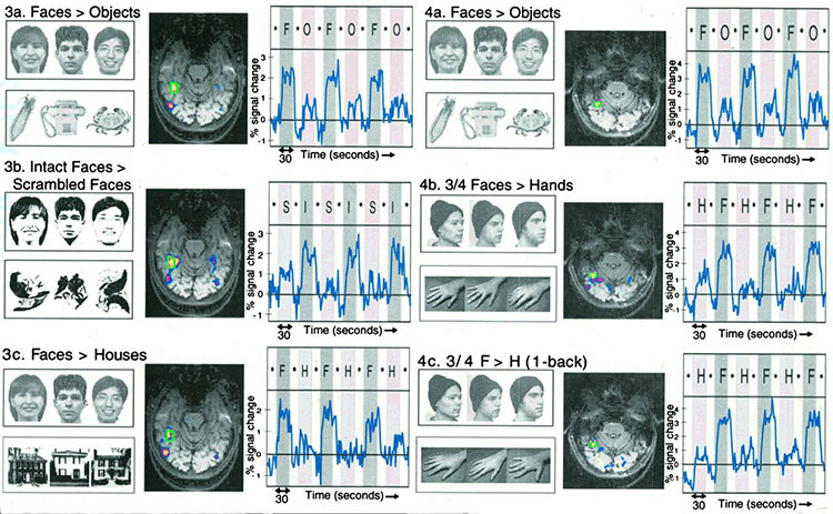 Image of brain activity