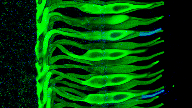 Cones in the primate retina labeled with an antibody against cone arrestin. A few blue cones were double-labeled with an antibody against blue cone opsin. The Journal of Neuroscience.