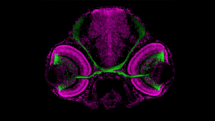 Image of a zebrafish's visual system