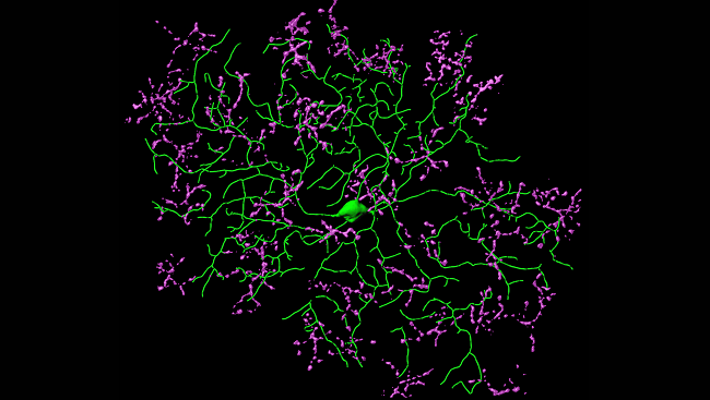 Studying these cells may help explain how some sightless individuals can still detect motion around them.