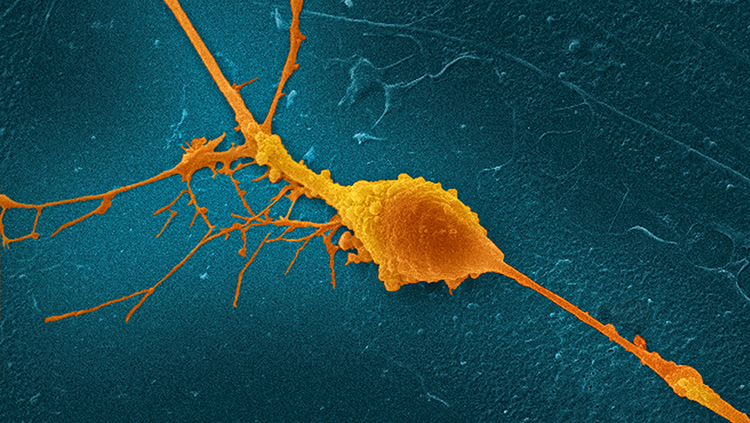 Retinal Ganglion Cell