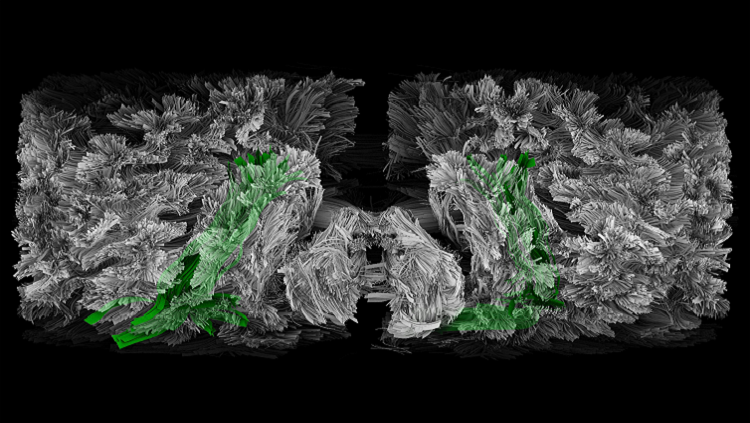 longitudinal fasciculus