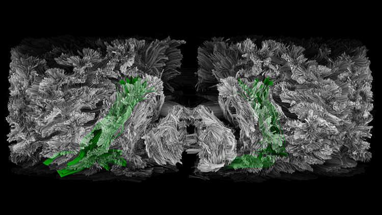 longitudinal fasciculus 