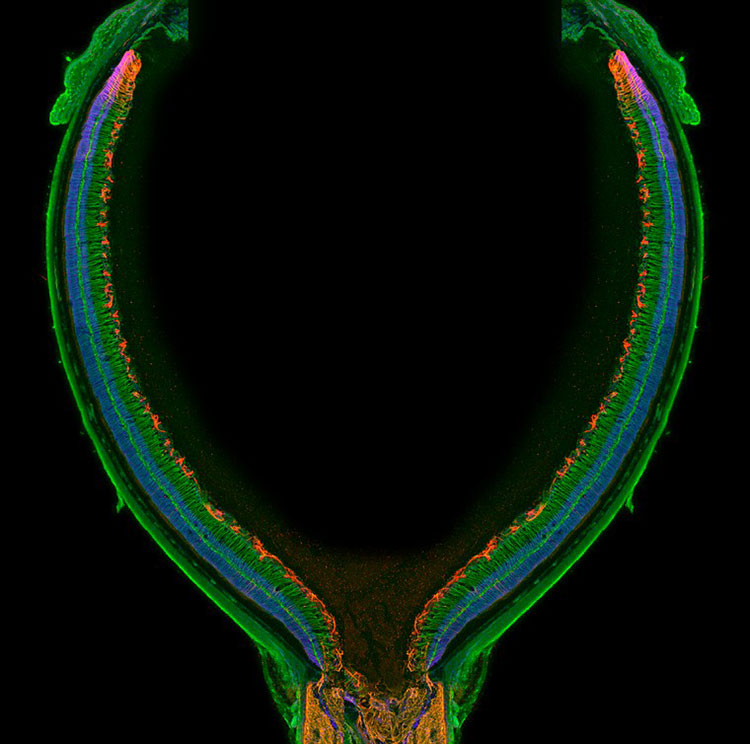 mouse retina astrocytes red