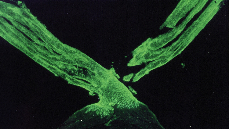 zebrafish optic chiasm green